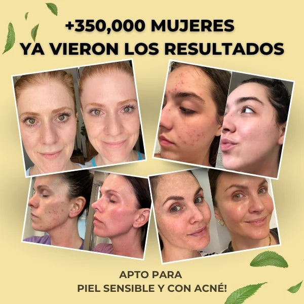 EVIL GOODS® - Bálsamo de miel y sebo de res Anti-Envejecimiento - 40% OFF